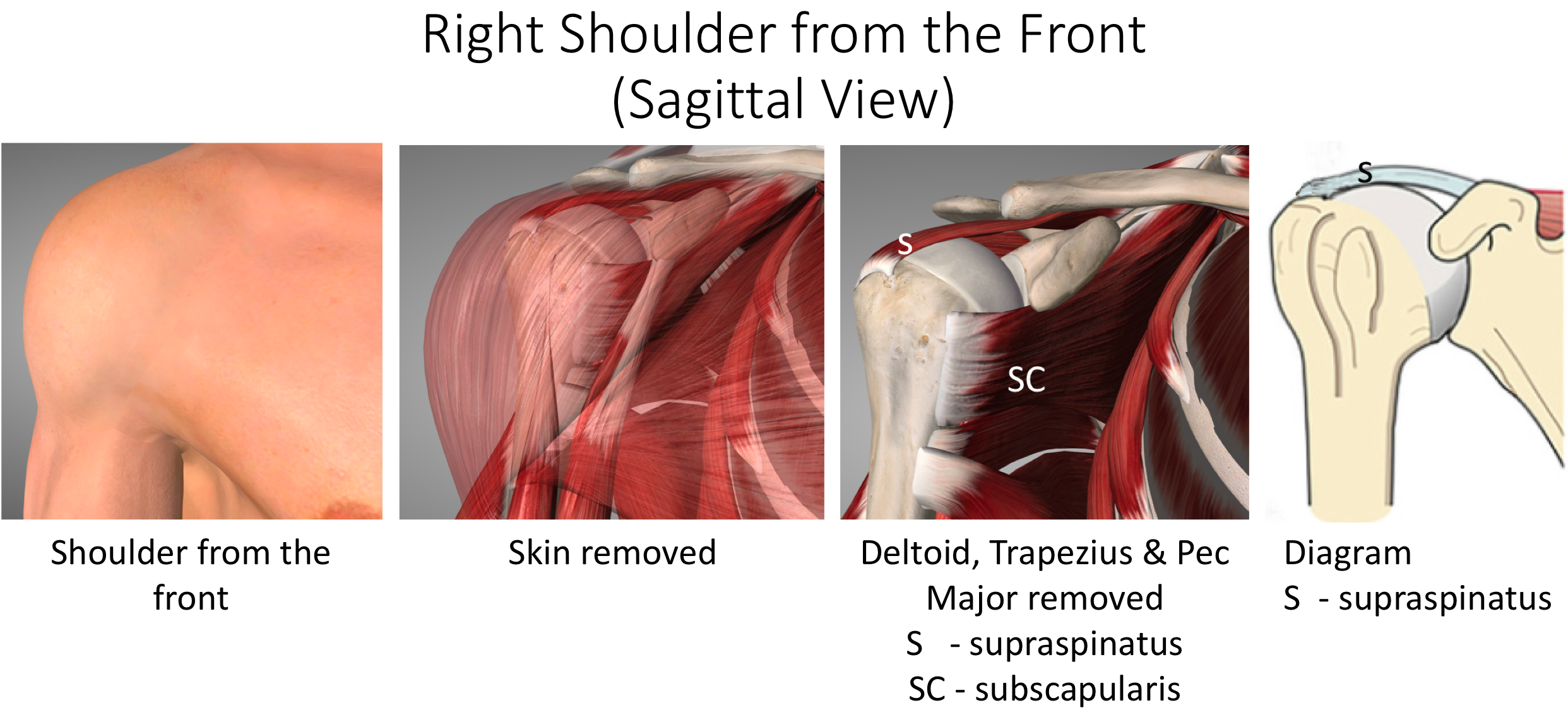 Fig 1 B. Shoulder from the Front