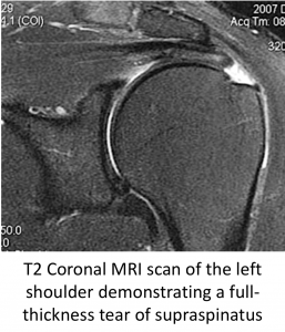 Fig 15. MRI Scan