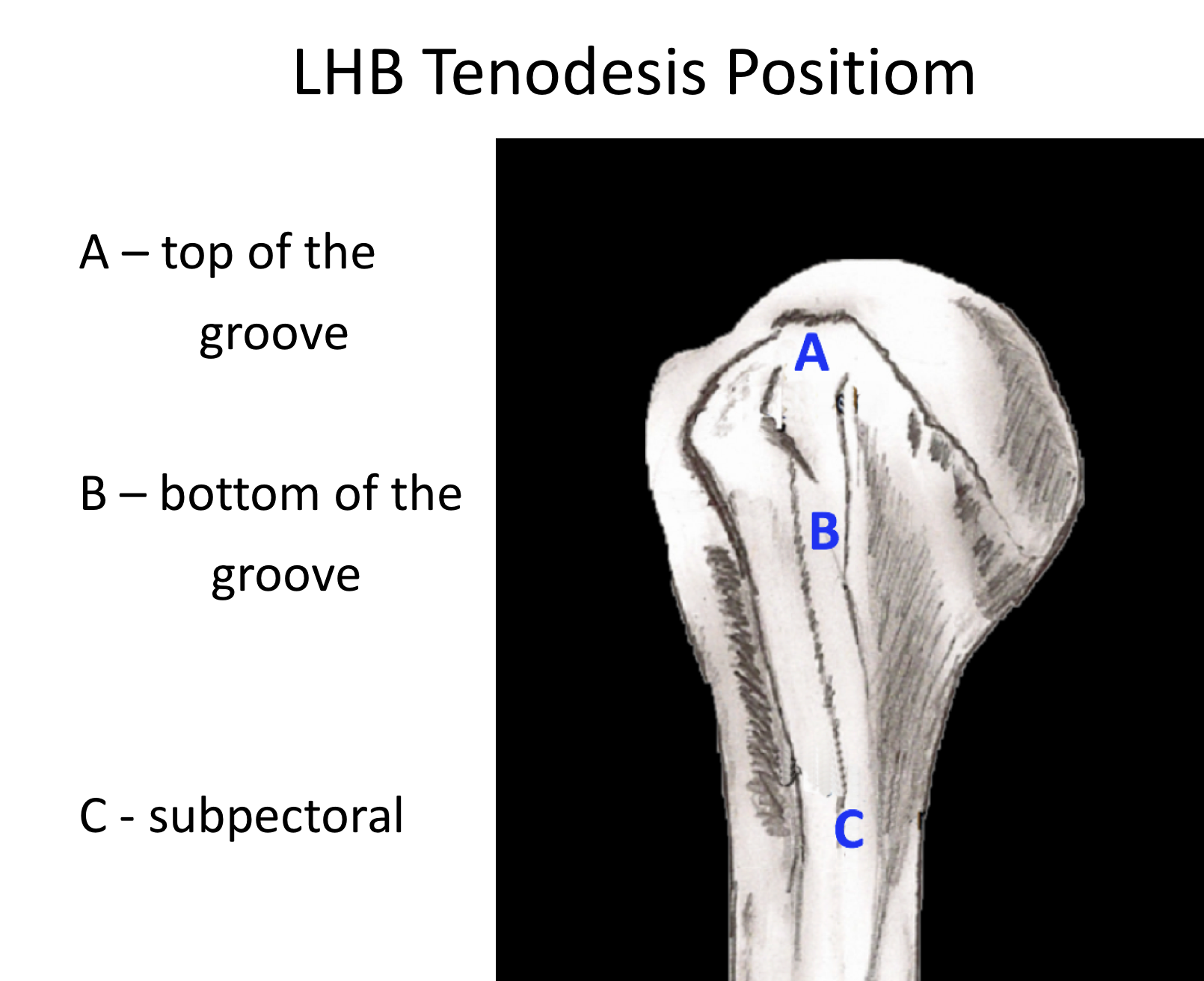 Fig 9. Tenodesis position