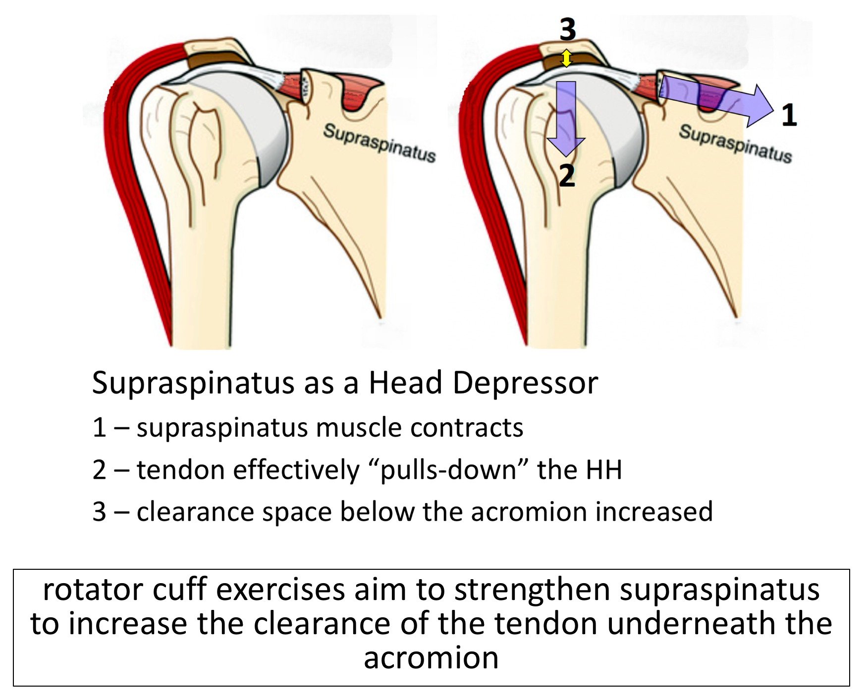 Supraspinatus Tendinopathy Physiopedia Rotator Cuff And Shoulder The