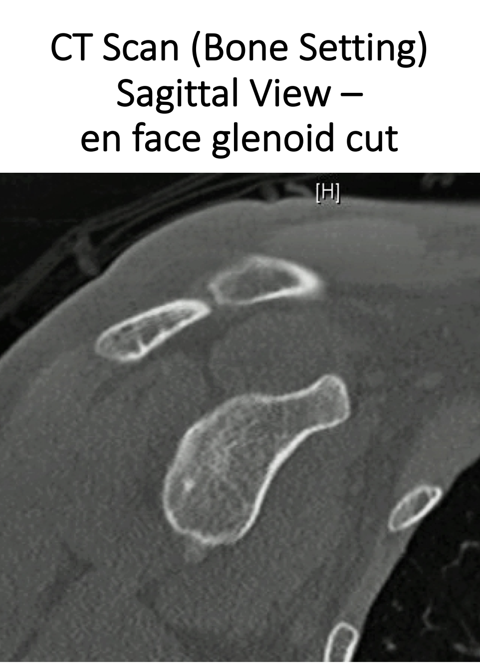 Fig 13. CT Sagittal